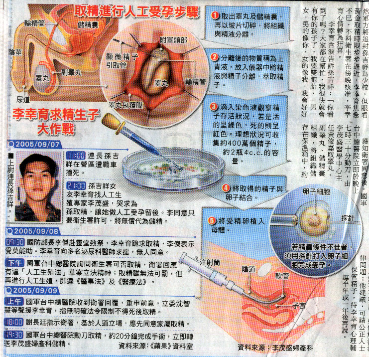 取精進行人工受孕步驟
