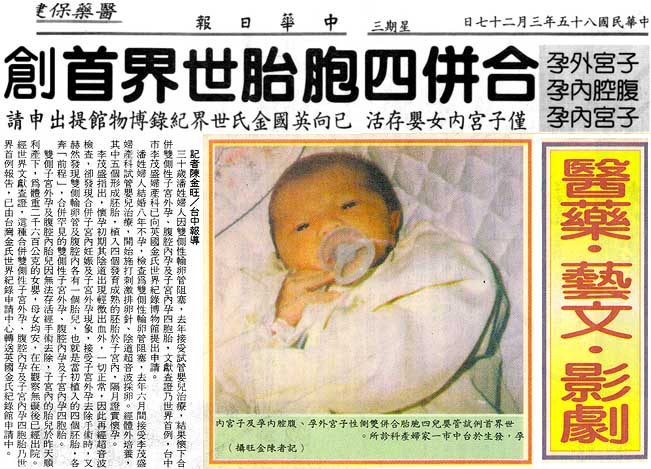 子宮外孕腹腔內孕子宮內孕合併四胞胎世界首例