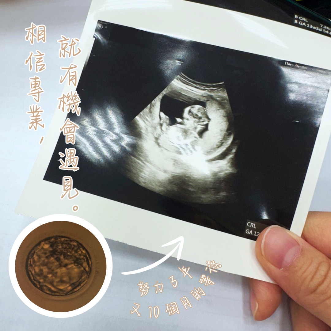 我始終相信院長一定會讓我擁有寶貝🧡
