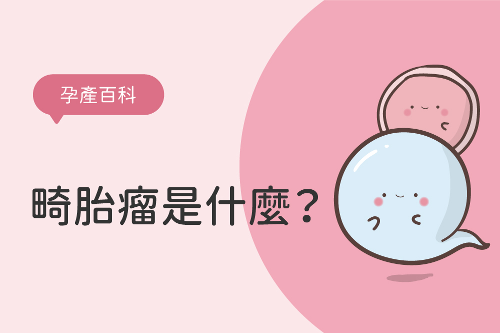 畸胎瘤是什麼？畸胎瘤成因與症狀有哪些？會影響懷孕嗎？