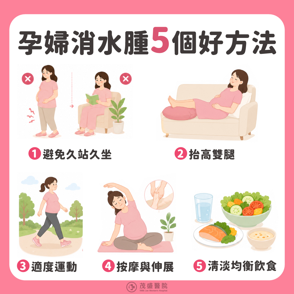 孕婦消水腫5個好方法