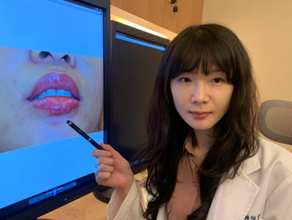 她懶塗口紅花錢紋唇　慘！宋慧喬「減齡豐唇」醜成香腸嘴