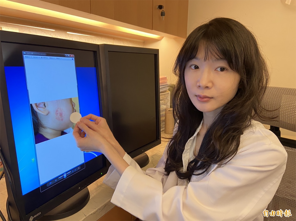 女童貼止癢貼布越貼越癢 醫：接觸性皮膚炎惹禍