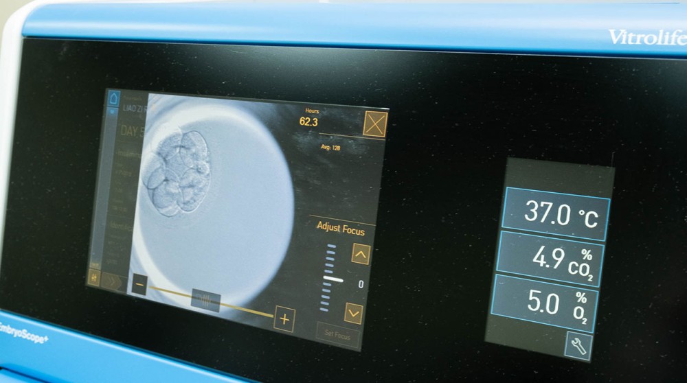 茂盛第4代AI試管技術 高齡求子幫手