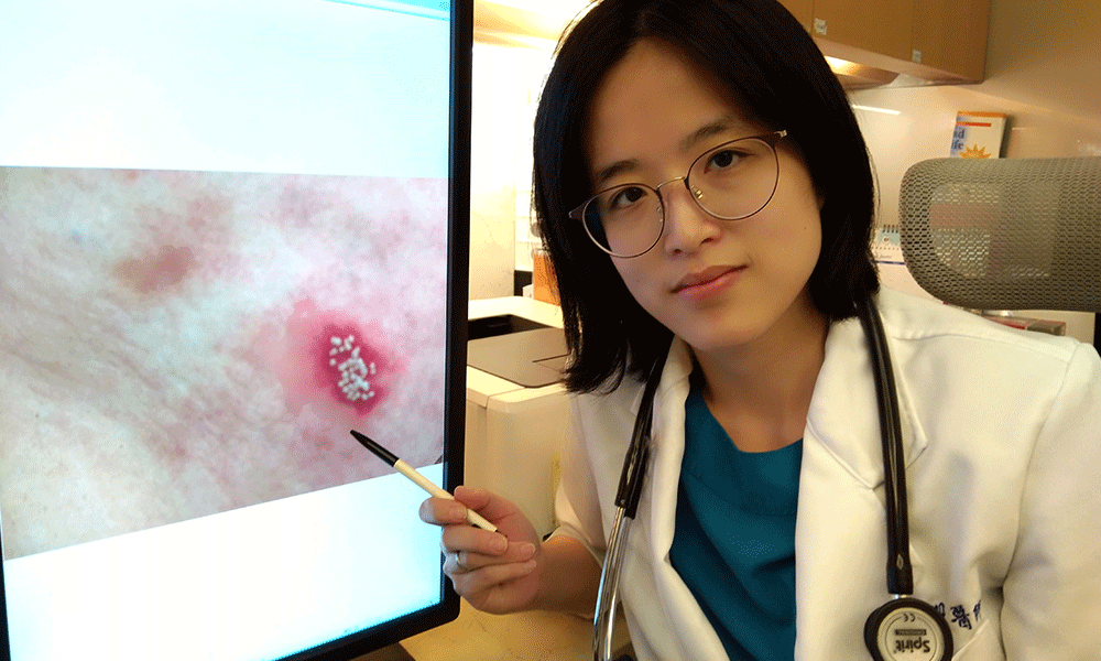 私密部位長疹痛又癢　竟糖尿病併發皰疹